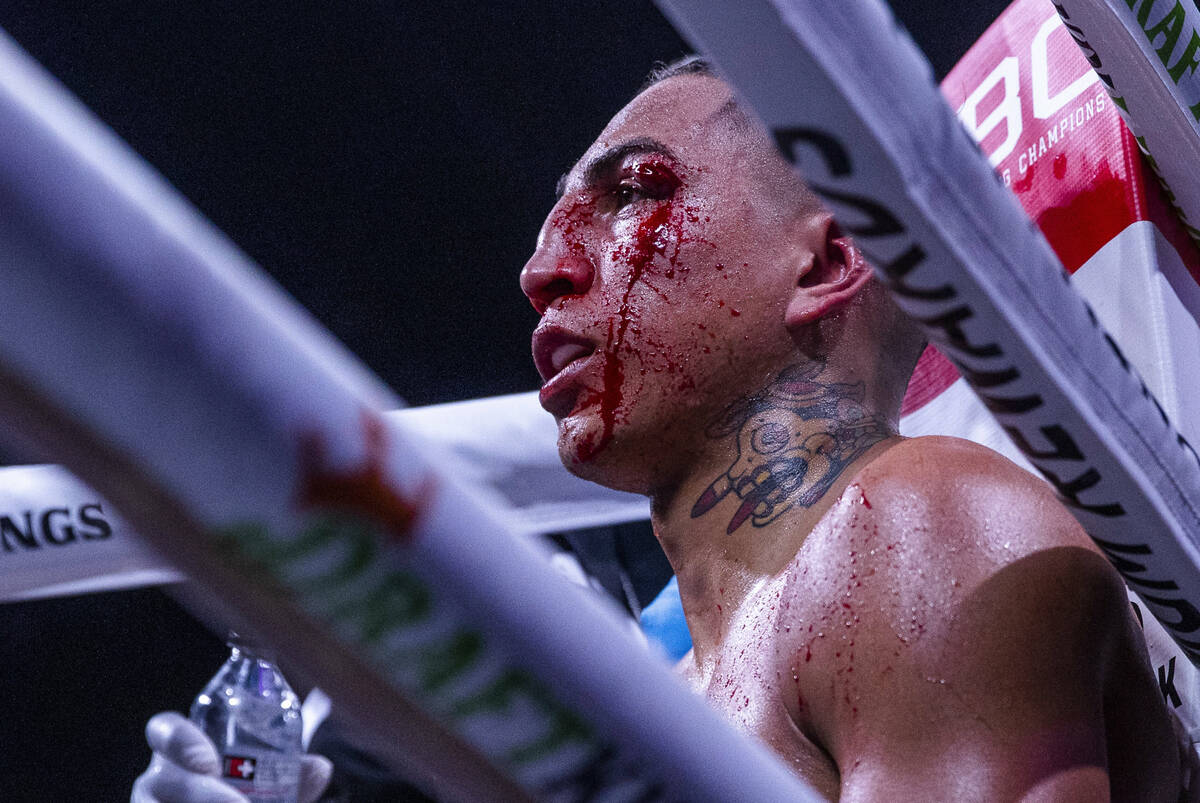 Mario Barrios sits bleeding after the eighth round versus Keith Thurman during their Welterweig ...