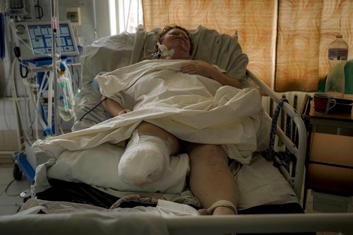 A woman whose leg had to be amputated after she suffered gunshot wounds in a village currently ...