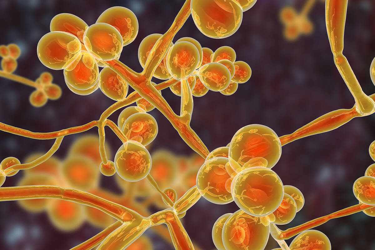 Candida auris is a drug-resistant “superbug” that can lead to serious illness and even deat ...