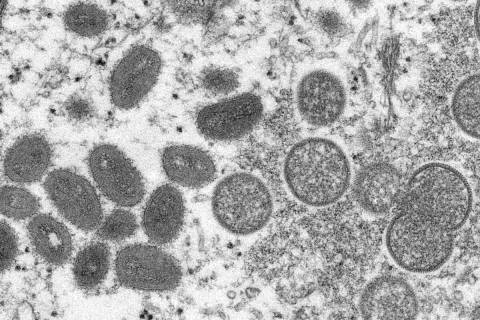 This 2003 image shows mature, oval-shaped monkeypox virions, left, and spherical immature virio ...