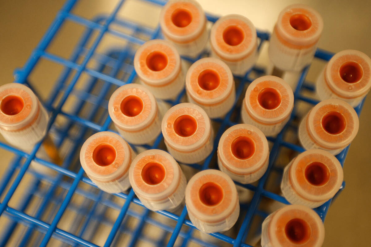 Samples of plasma are seen at the Grifols Biomat USA Plasma Center on Tropicana Avenue, Wednesd ...
