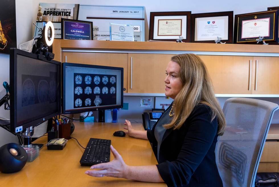 Jessica Caldwell memeriksa pemindaian otak di Pusat Kesehatan Otak Lou Ruvo.  (LE Baskow/Las ...