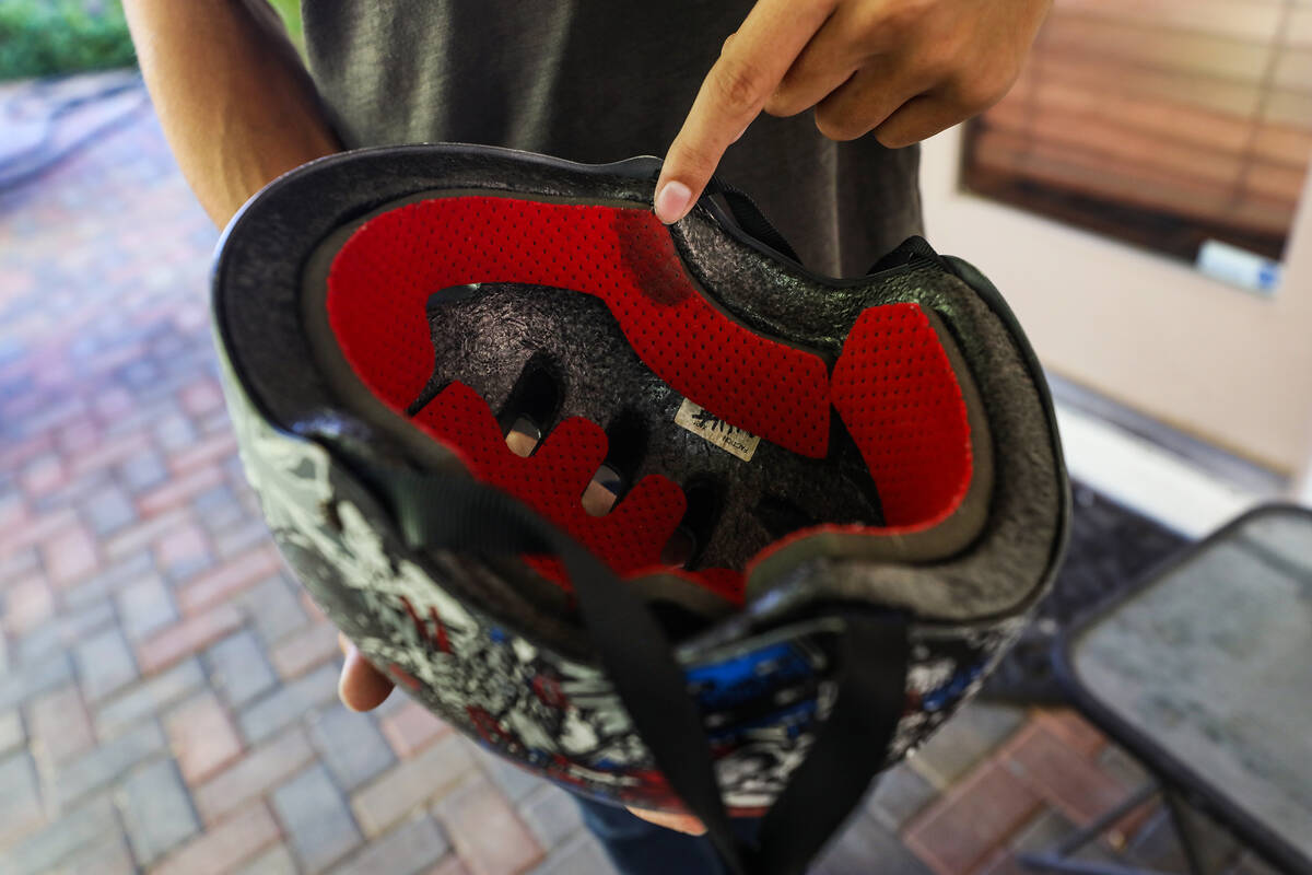 Alex Wigg shows blood on the helmet that he wore at age 11, when he was struck by a car while b ...