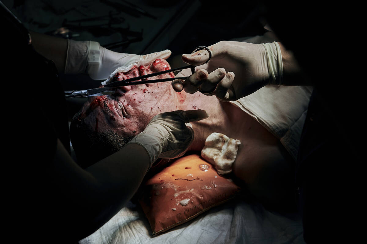 EDS NOTE: GRAPHIC CONTENT - Medics operate on a Ukrainian soldier wounded in a battle with the ...
