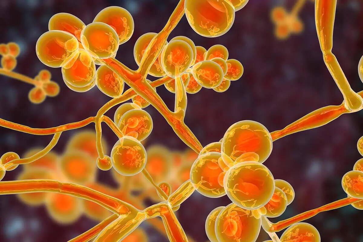 Candida auris fungi, emerging multidrug resistant fungus, 3D illustration (Getty Images)