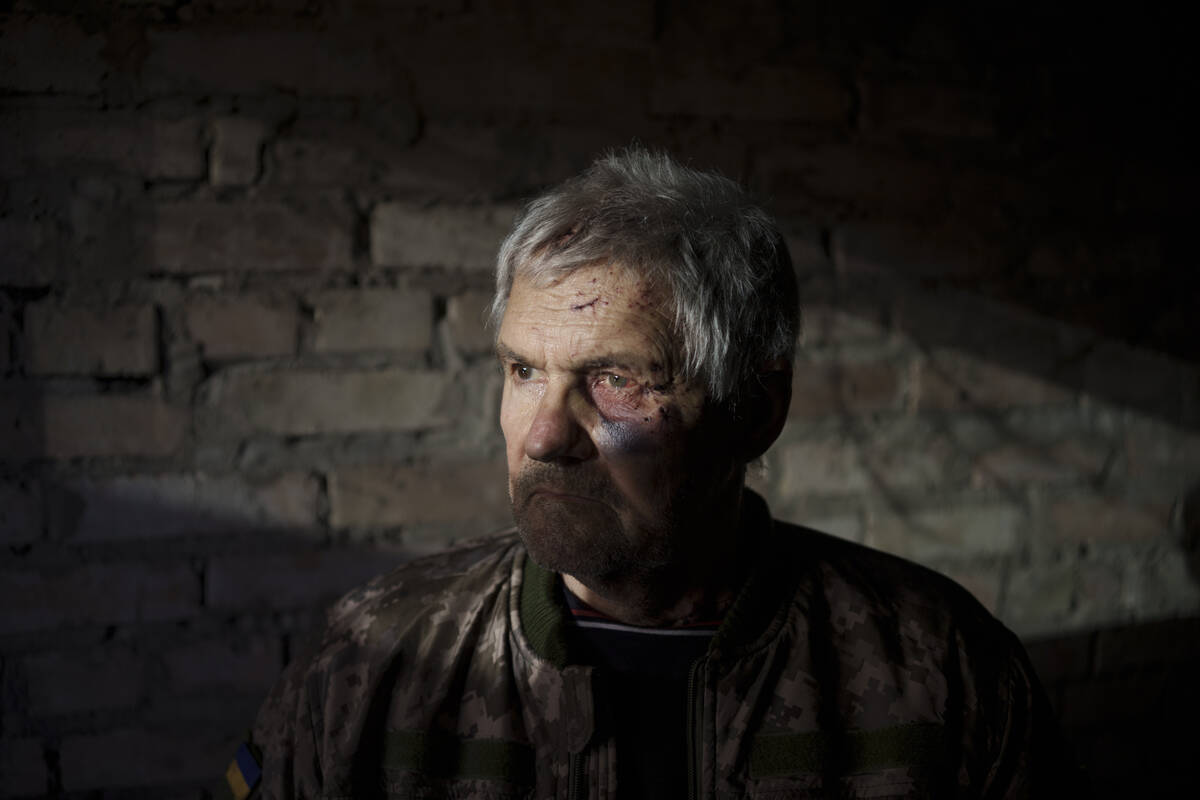Anatolii Kaharlytskyi, 73, stands inside his house, heavily damaged after a Russian attack in K ...