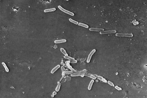 This scanning electron microscope image made available by the Centers for Disease Control and P ...