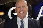Experts explain Bruce Willis’ rare form of dementia: FTD