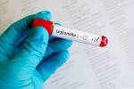 Health district investigates outbreak of Legionnaires’ disease