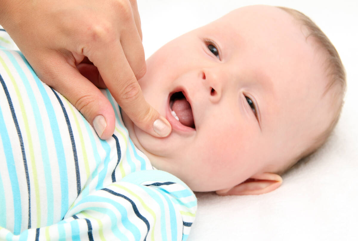 Tanya Dokter Spesialis Anak: Seberapa Pentingkah Merawat Gigi Susu?