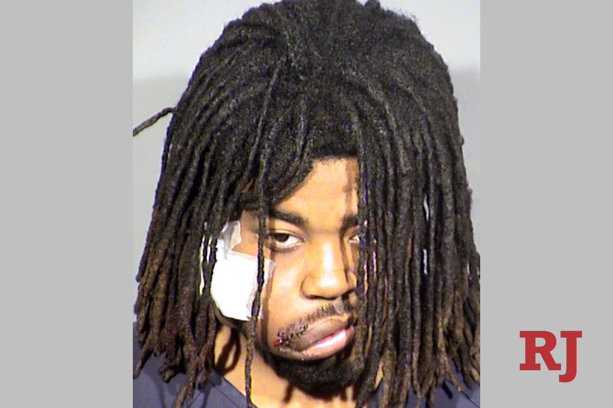 Tersangka pembunuhan mengatakan dia mabuk jamur, kata polisi Las Vegas
