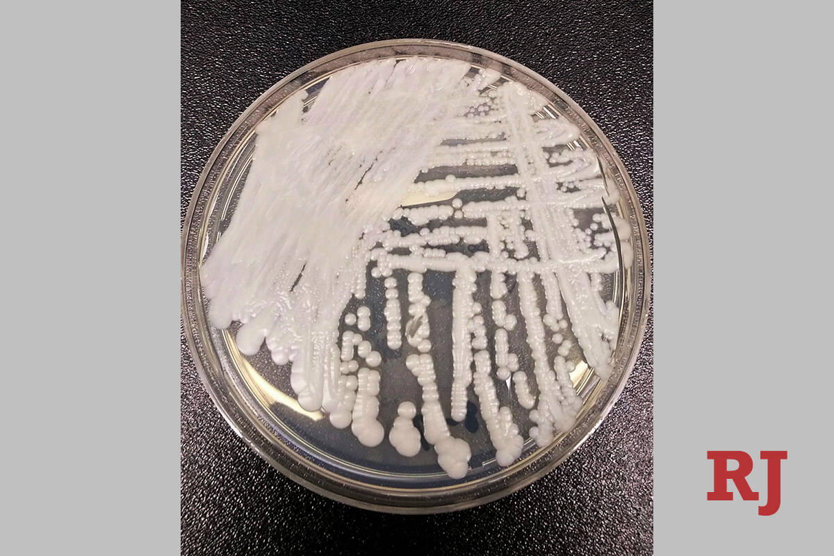 Is the Candida auris fungus spreading outside of hospitals and medical settings?