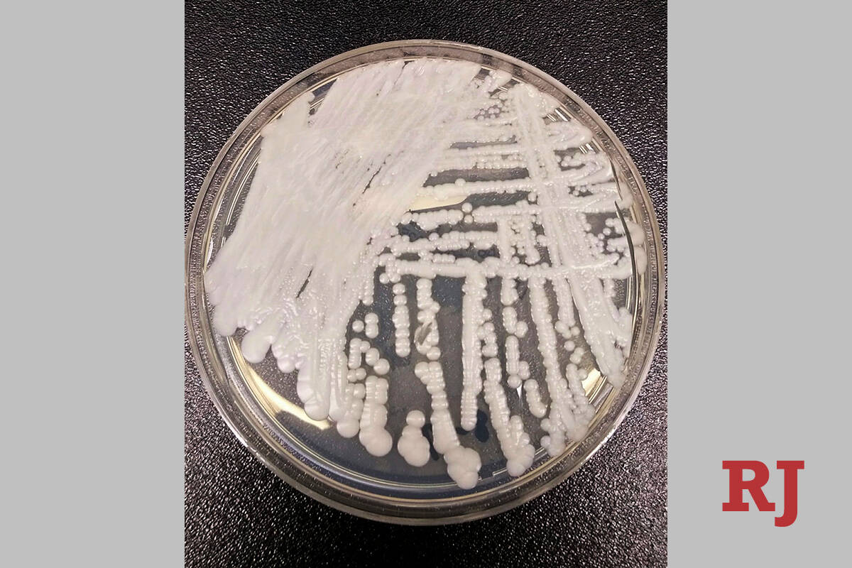 This photo shows a strain of Candida auris cultured in a petri dish at a CDC laboratory. (Shaw ...