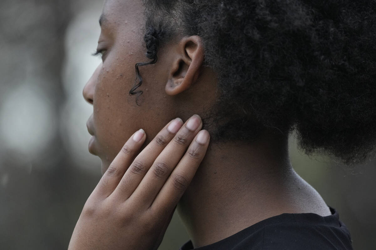 Makena, a high school senior in Mississippi, pulls at her hair as she speaks during a visit to ...