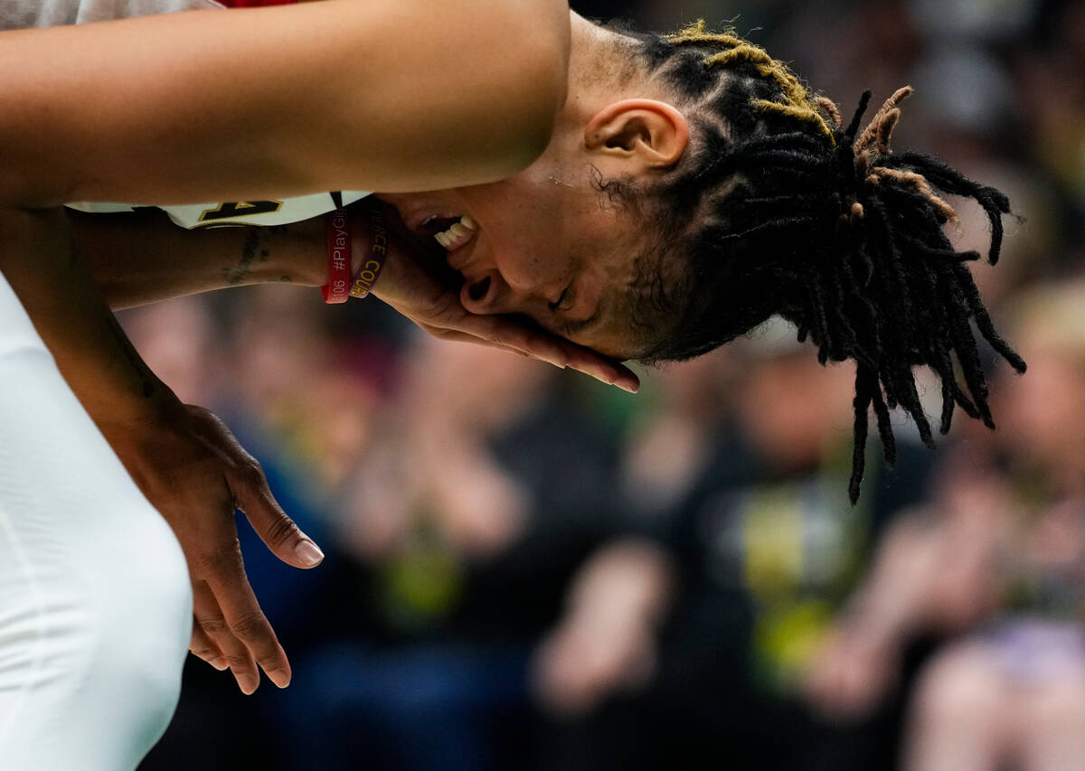 Las Vegas Aces forward Candace Parker holds her eye after a collision at the net during the fir ...