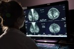 Mammograms should start at age 40, health panel says