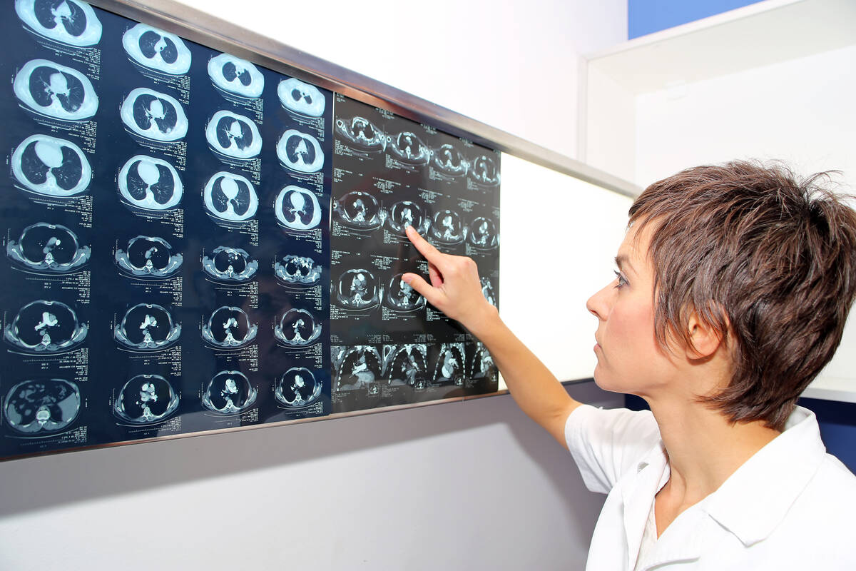 Diagnosing a blood clot may require diagnostic imaging or other testing. (Getty Images)