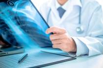 “Your lungs don’t just help you breathe — they also help to deliver oxygen ...