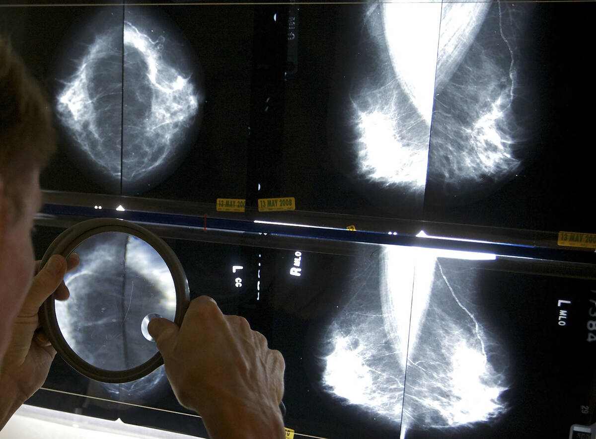 The general recommendation for women of average risk is to begin annual mammograms — pre ...