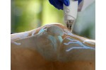 Introducing iovera°: A Cool Way to Manage Pain for Osteoarthritis