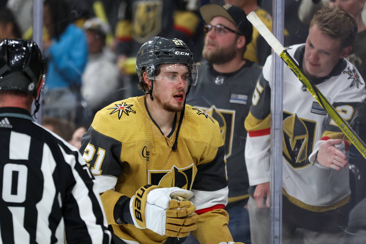 Golden Knights center Brett Howden (21) has a bloody face after being checked during the first ...