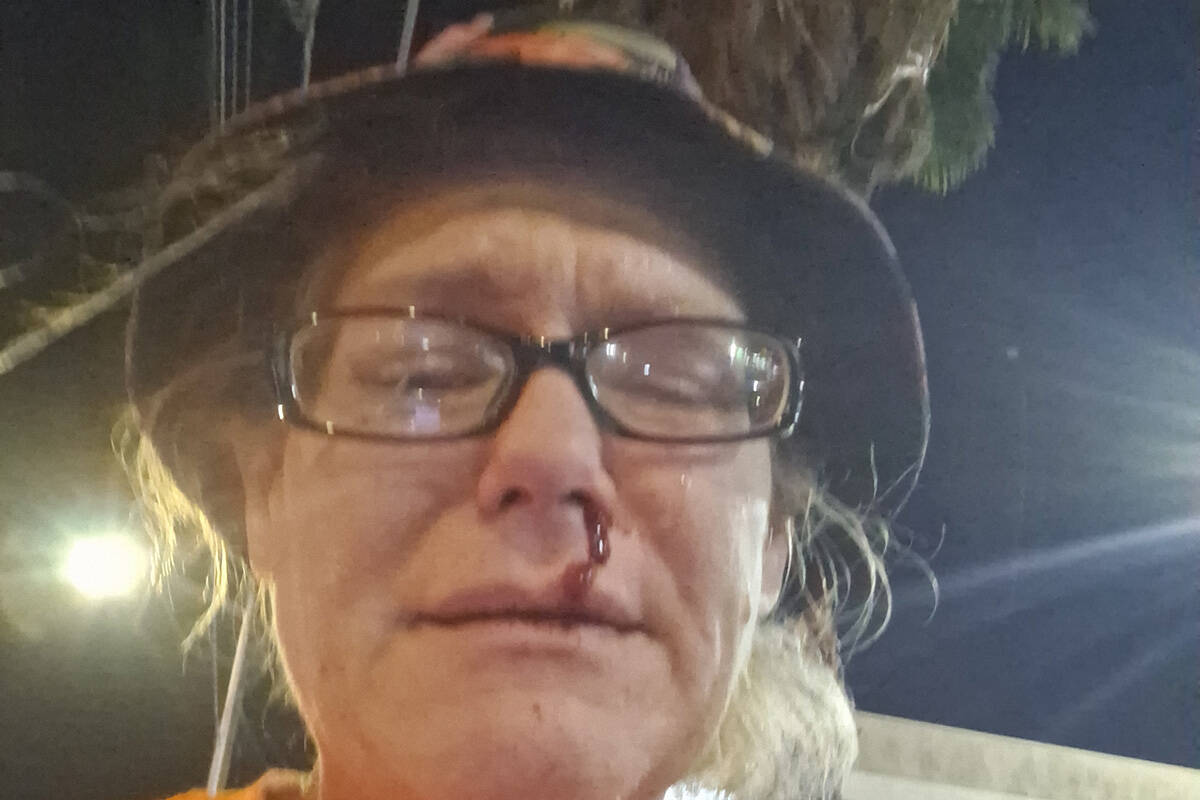 Clark County election worker says man attacked her at bus stop after