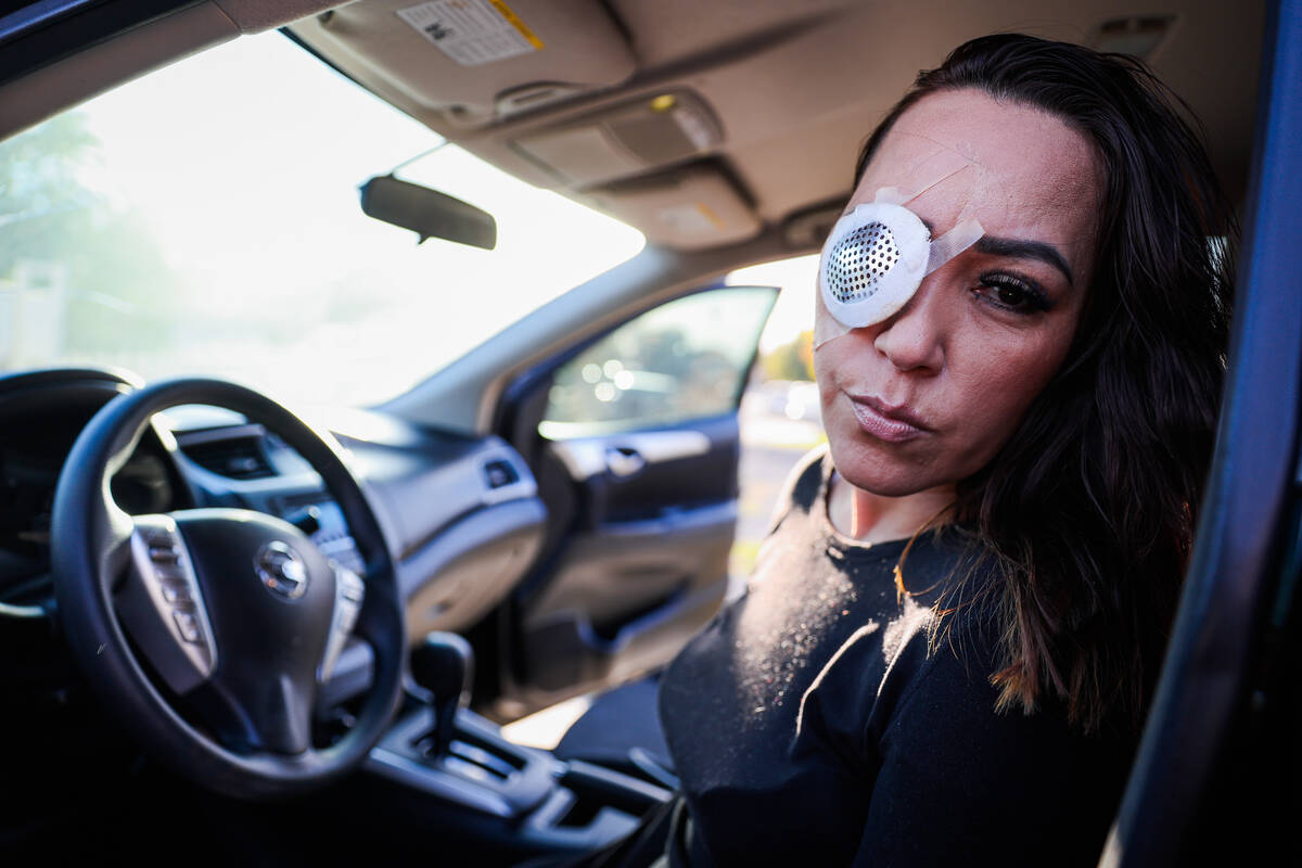 Martha Carbajal, who was shot while driving after making a wrong turn, poses for a portrait ins ...