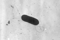 This 2002 electron microscope image made available by the Centers for Disease Control and Preve ...