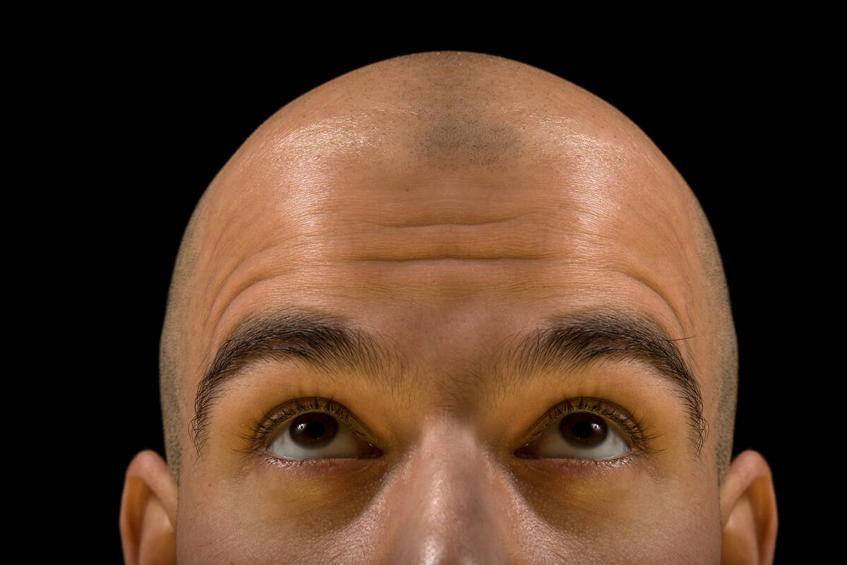 New research published in Nutrition and Health, analyzing 17 studies on diet and hair, shows ce ...