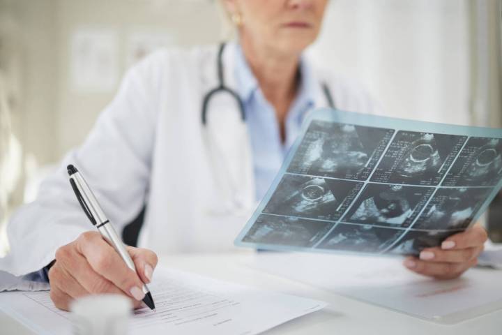Statistics show that 1 in 8 women will get breast cancer, so screening is a critical tool for e ...